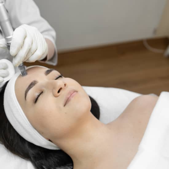 Official cover of the event Bono Dermapen – Rejuvenecimiento Intensivo de la Piel